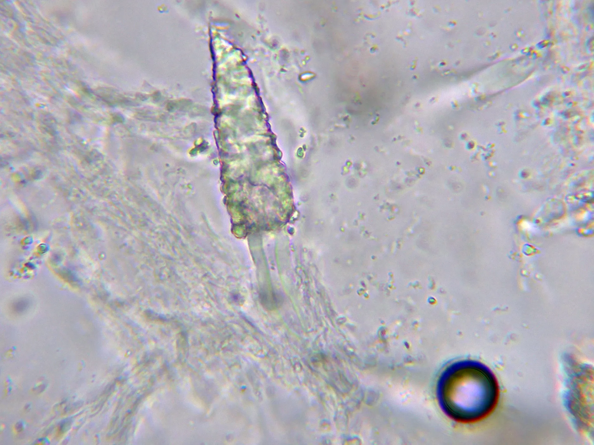 Microscopía de Rhizochaete filamentosa - 10 - Cistidio KOH-004